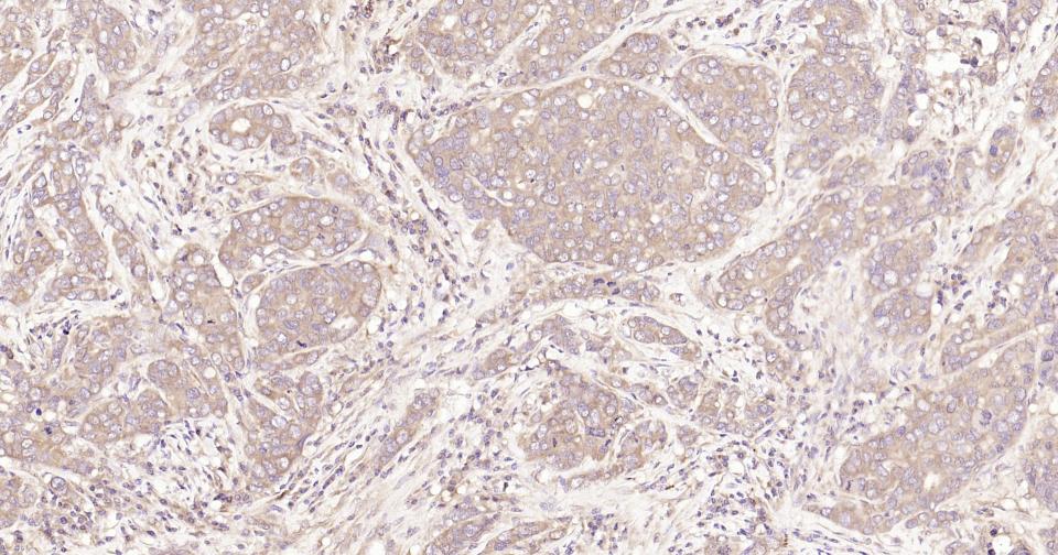 Rabbit anti-Stat3 Monoclonal Antibody