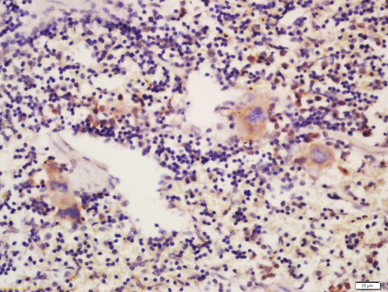 Rabbit Anti-THSD1 Polyclonal Antibody