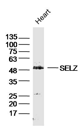 Rabbit anti-TRXRD2 Polyclonal Antibody