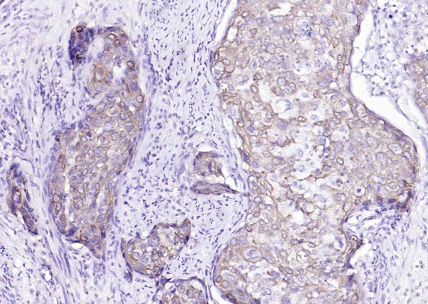 Mouse anti-Cytokeratin 8 Monoclonal Antibody
