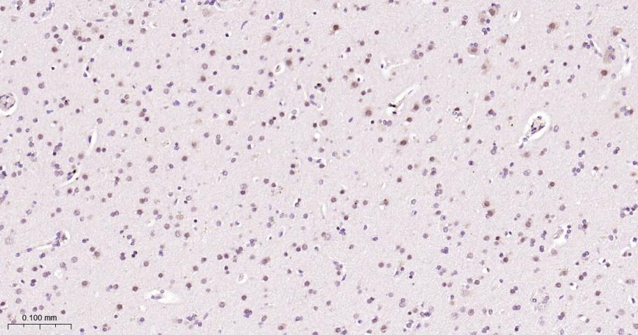 Rabbit anti-NADPH Oxidase 4 Monoclonal Antibody
