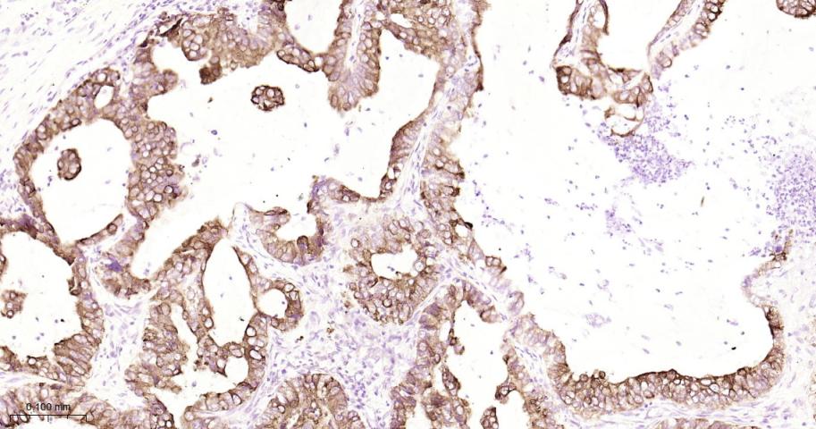Rabbit anti-AGR2 Monoclonal Antibody