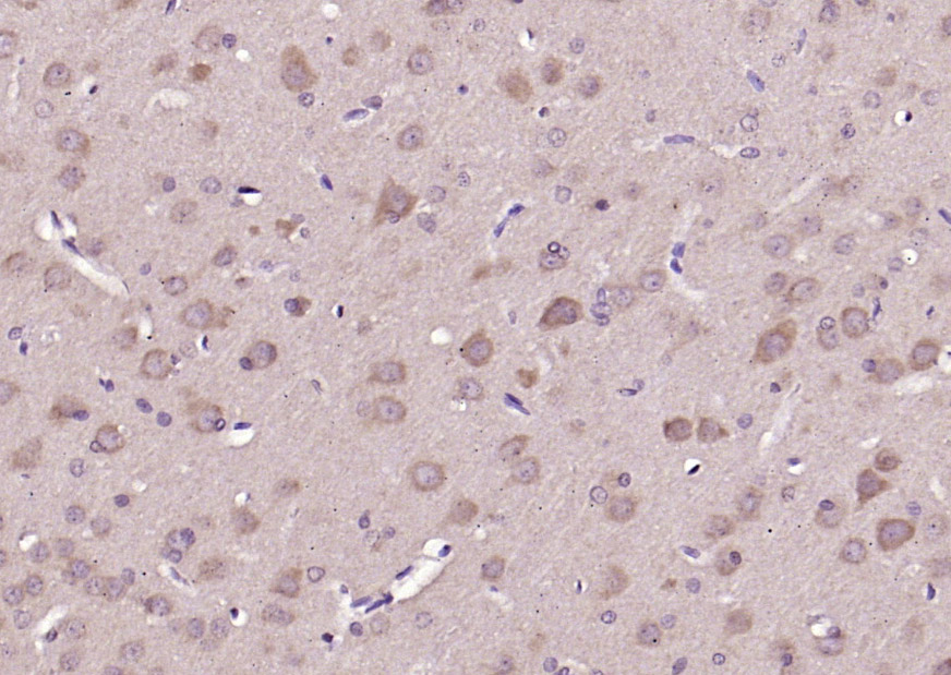 Rabbit anti-Phospho-P38 MAPK(Thr180) Polyclonal Antibody