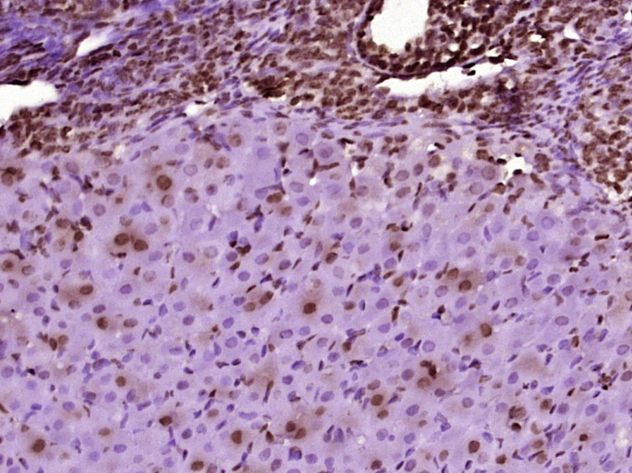 Rabbit anti-Phospho-TH(Ser31) Polyclonal Antibody