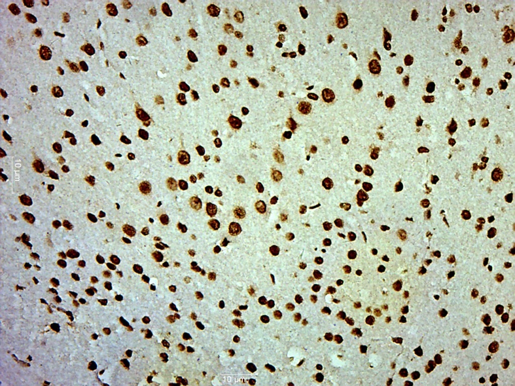 Rabbit anti-Phospho-PI3 Kinase p110 β(Ser1070) Polyclonal Antibody
