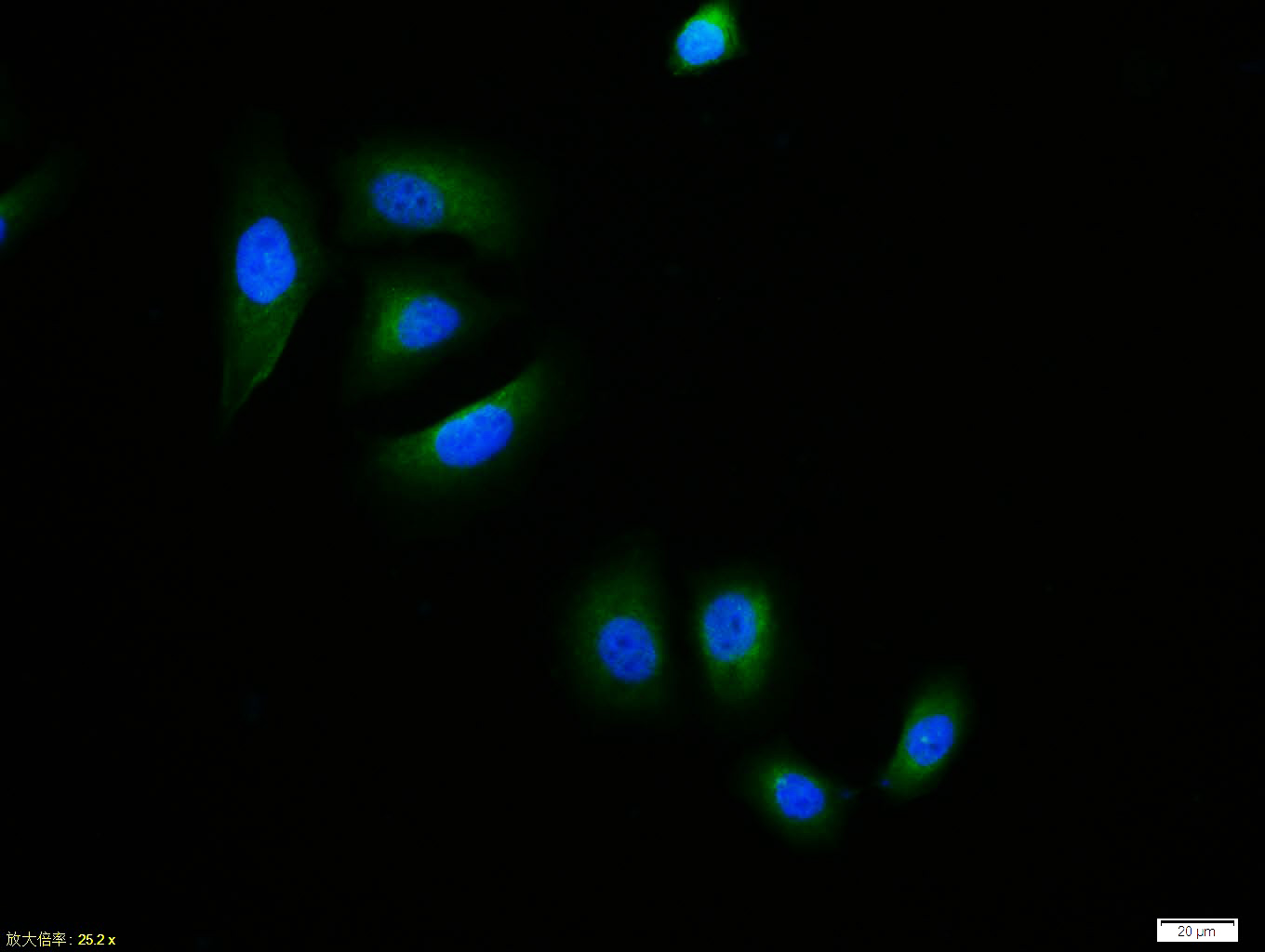Rabbit anti-Phospho-IKB α(Ser32+Ser36) Polyclonal Antibody