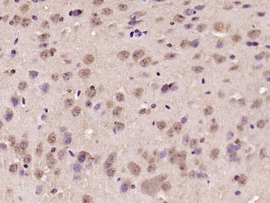 Rabbit anti-BTBD19 Polyclonal Antibody