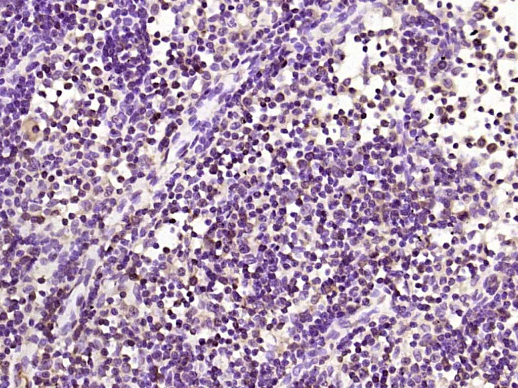 Rabbit anti-Phospho-PKC δ(Tyr52) Polyclonal Antibody