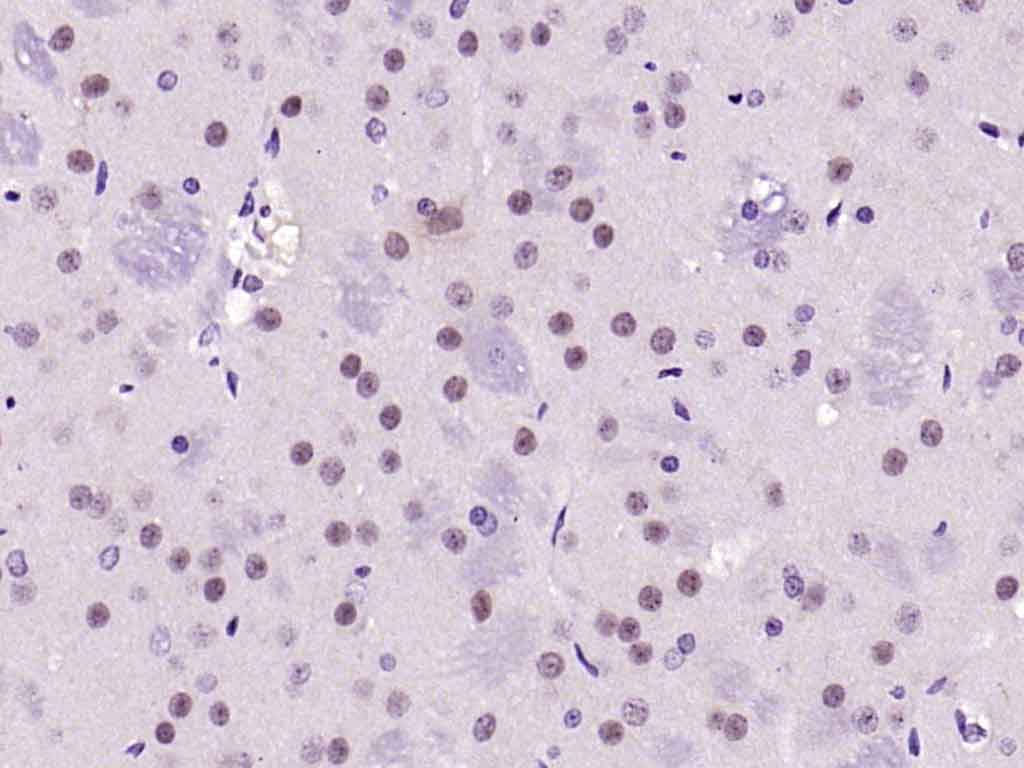 Rabbit anti-Phospho-FAK(Tyr576+Tyr577) Polyclonal Antibody