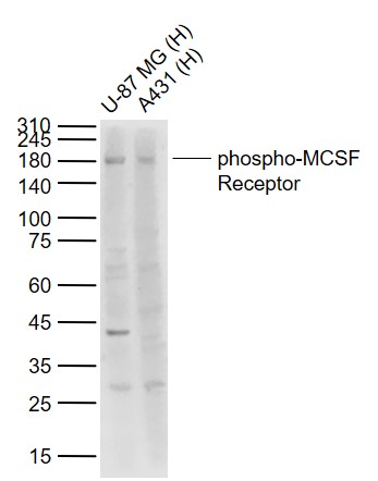Rabbit anti-Phospho-MCSF Receptor(Tyr546) Polyclonal Antibody