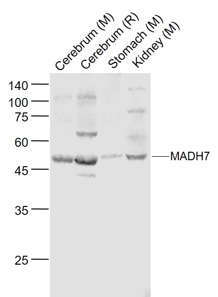 Rabbit anti-MADH7 Polyclonal Antibody