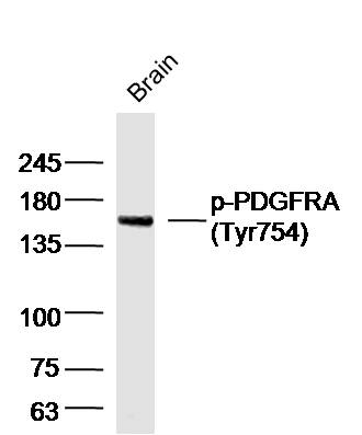 Rabbit anti-Phospho-PDGFRA(Tyr754) Polyclonal Antibody