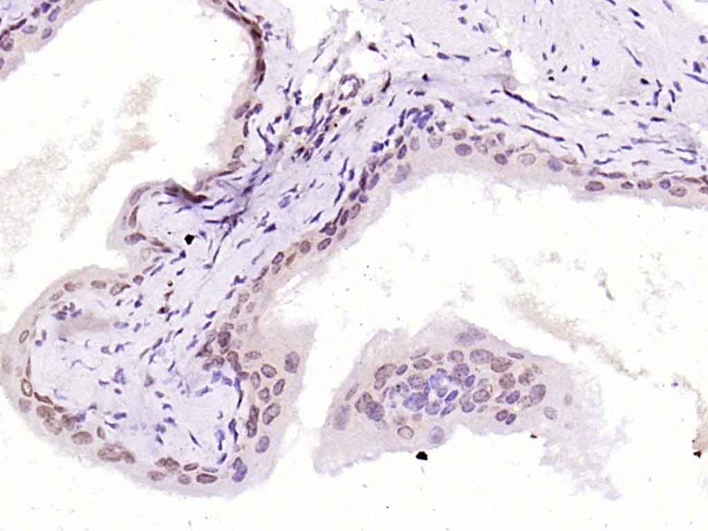 Rabbit anti-HMG4 Polyclonal Antibody