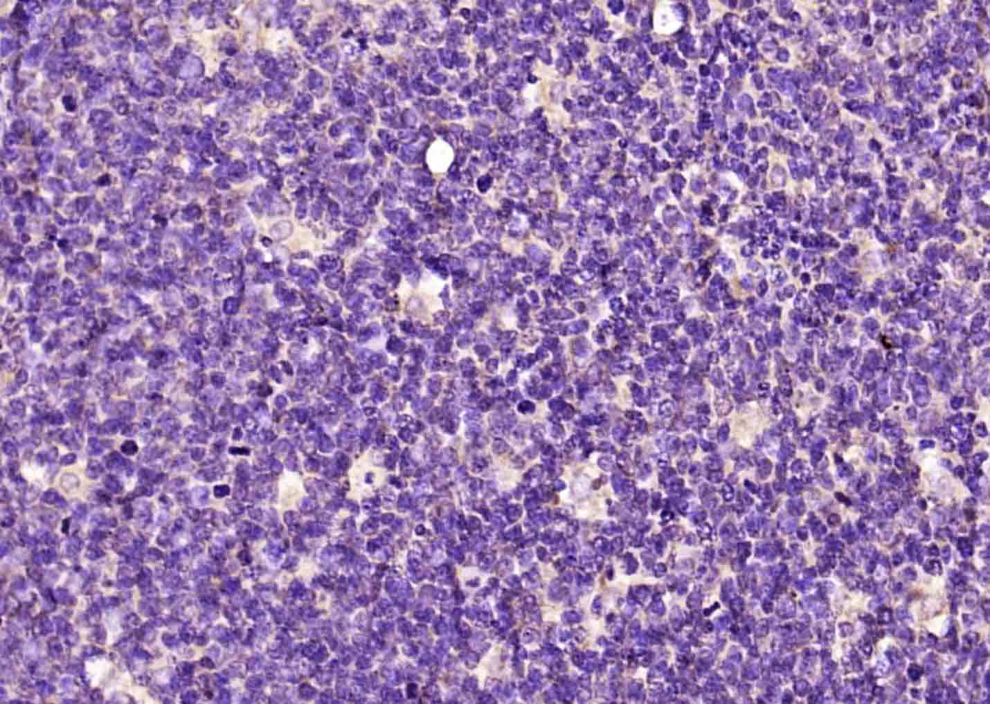 Rabbit anti-Phospho-Bcl-2(Ser70) Polyclonal Antibody