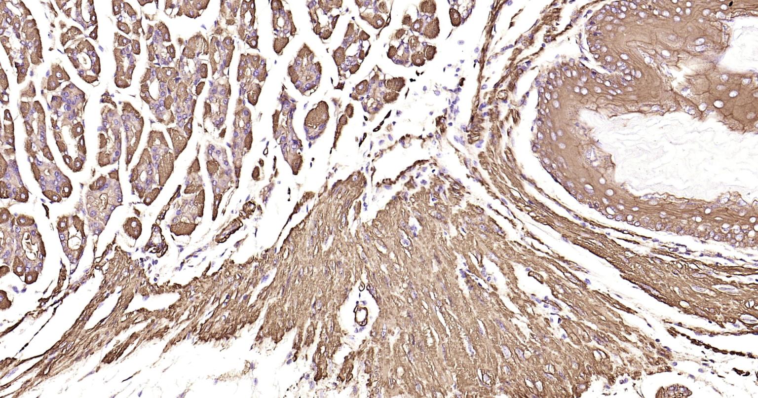 Rabbit anti-α Smooth Muscle Actin Monoclonal Antibody