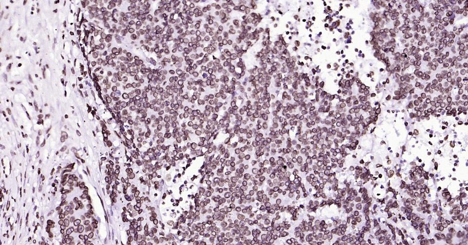 Rabbit anti-Lamin B1 Monoclonal Antibody