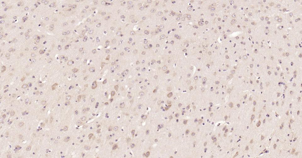 Rabbit anti-Stat3 Monoclonal Antibody