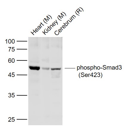 Rabbit anti-Phospho-Smad3(Ser423) Polyclonal Antibody