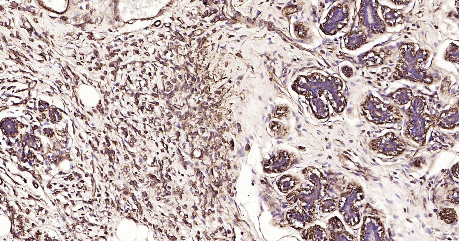 Rabbit anti-α Smooth Muscle Actin Monoclonal Antibody