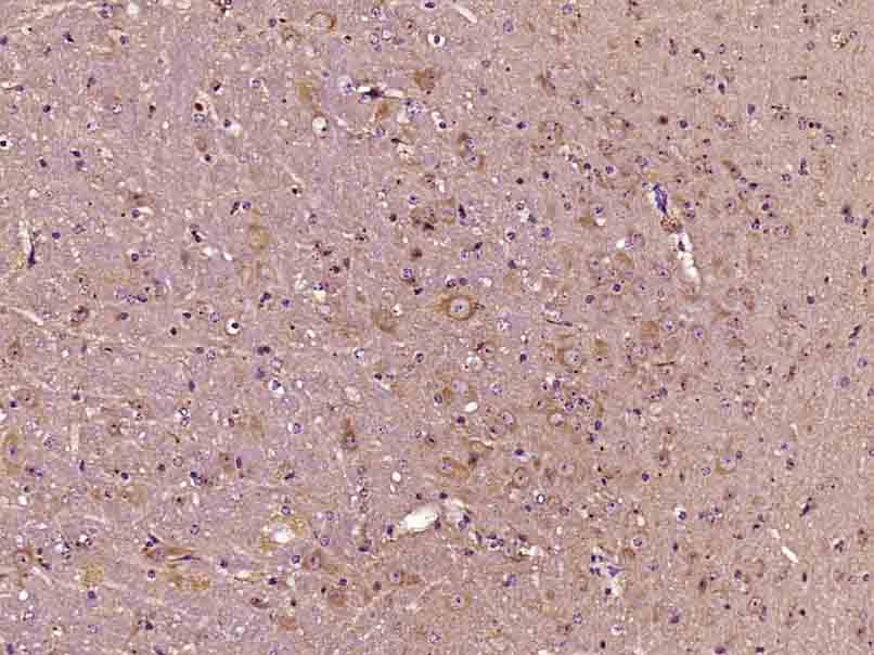 Rabbit anti-Phospho-AKT1(Thr34) Polyclonal Antibody