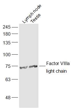 Rabbit Anti-Factor VIIIa light chain Polyclonal Antibody