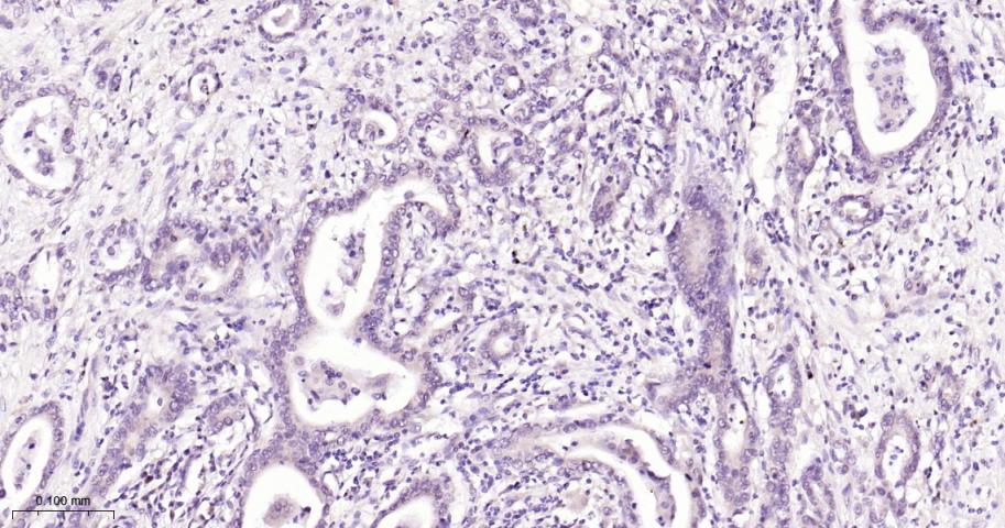 Rabbit anti-NADPH Oxidase 4 Monoclonal Antibody