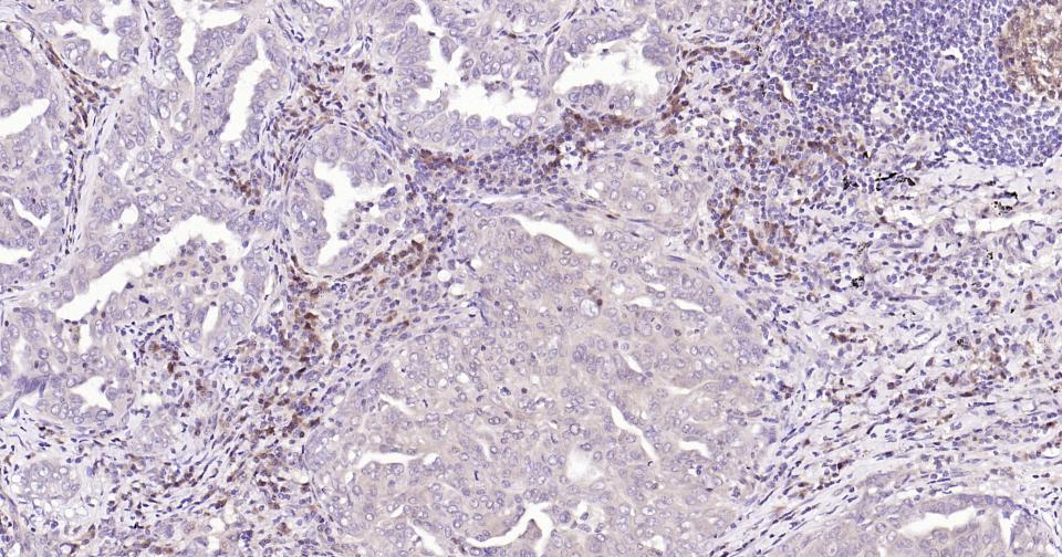 Rabbit anti-Caspase-3 Monoclonal Antibody