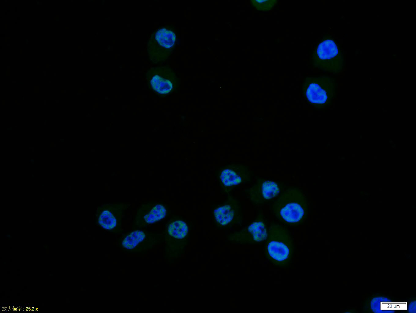 Rabbit anti-Phospho-NFKB p65(Ser276) Polyclonal Antibody