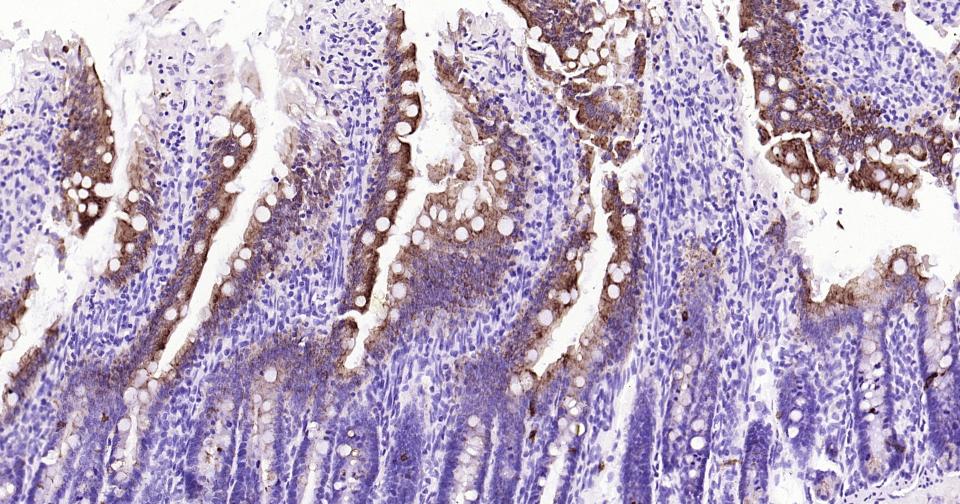 Rabbit anti-CK20 Monoclonal Antibody