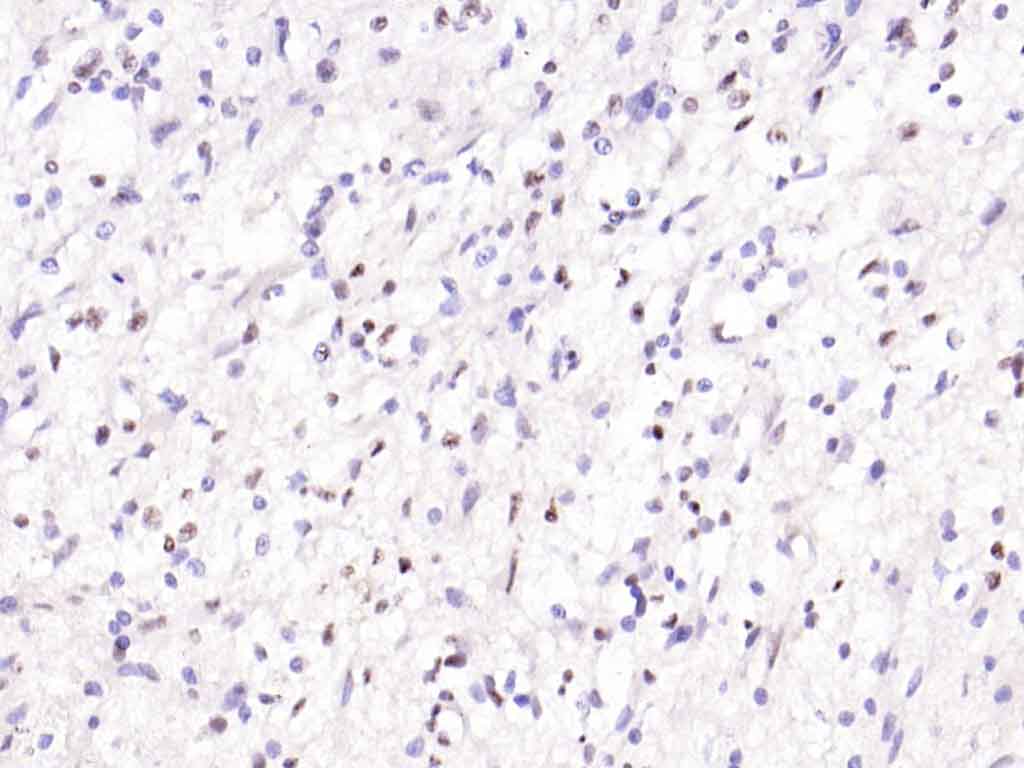 Rabbit anti-Phospho-Smad2(Ser467) Polyclonal Antibody