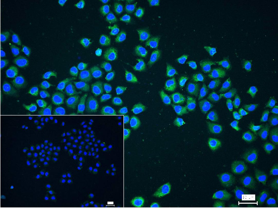 Rabbit anti-NFKB p65 Monoclonal Antibody