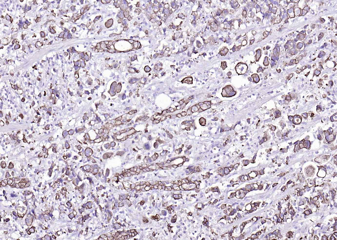 Mouse anti-Cytokeratin 8 Monoclonal Antibody