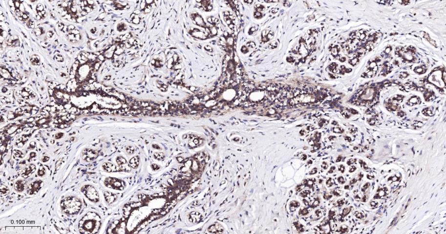 Rabbit anti-TSG101 Monoclonal Antibody
