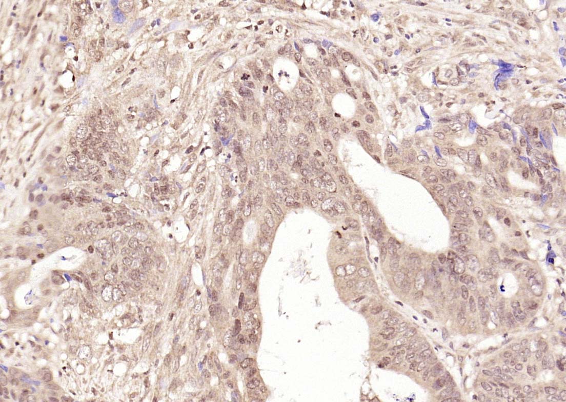 Rabbit anti-NFkB p105 Polyclonal Antibody