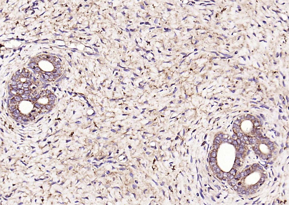 Rabbit anti-SOD2 Polyclonal Antibody