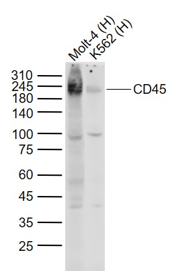 Mouse anti-CD45 Monoclonal Antibody
