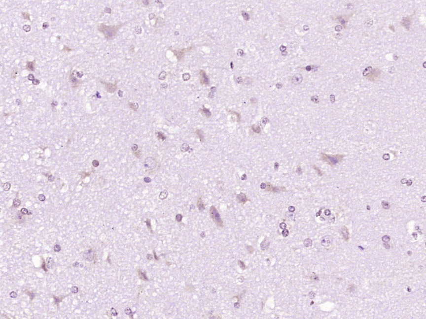 Rabbit anti-Phospho-PDGFRA(Tyr849) /PDGFRB(Tyr857) Polyclonal Antibody