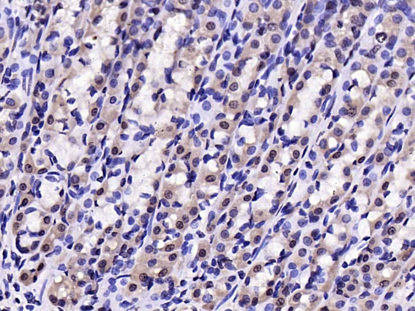 Rabbit anti-Phospho-IKBα(Tyr305) Polyclonal Antibody