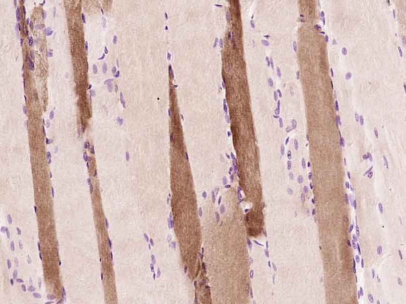 Rabbit anti-Myoglobin Polyclonal Antibody