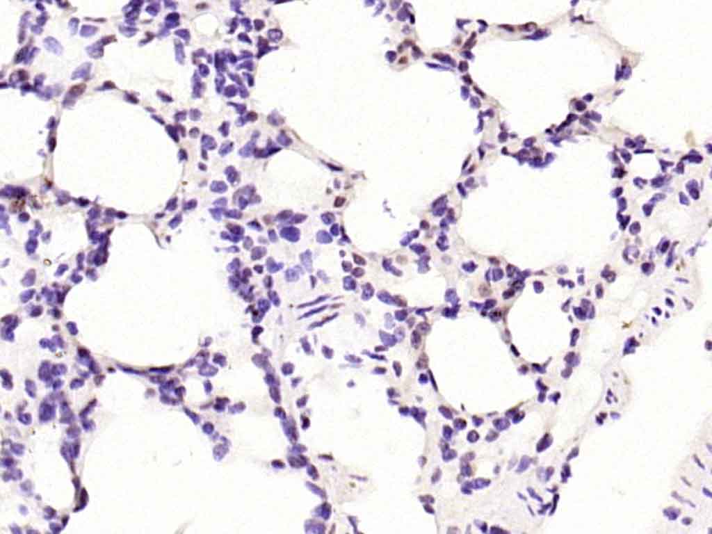 Rabbit anti-MADH7 Polyclonal Antibody