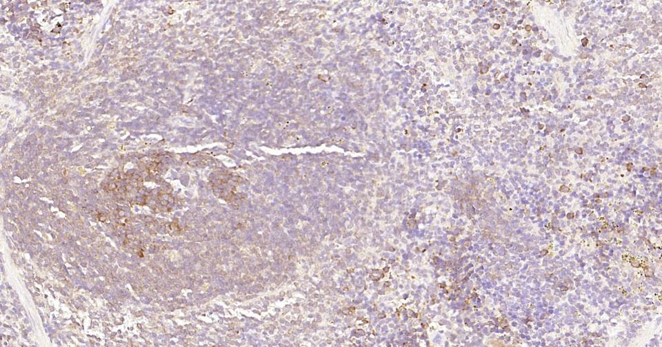 Rabbit anti-NFKB p65 Monoclonal Antibody