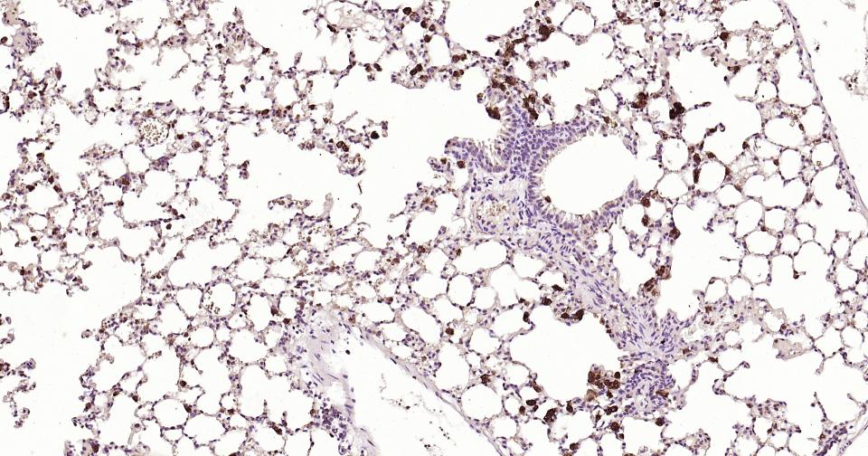 Rabbit anti-Galectin 3 Polyclonal Antibody