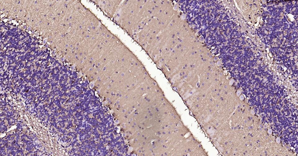 Mouse anti-S100B Monoclonal Antibody