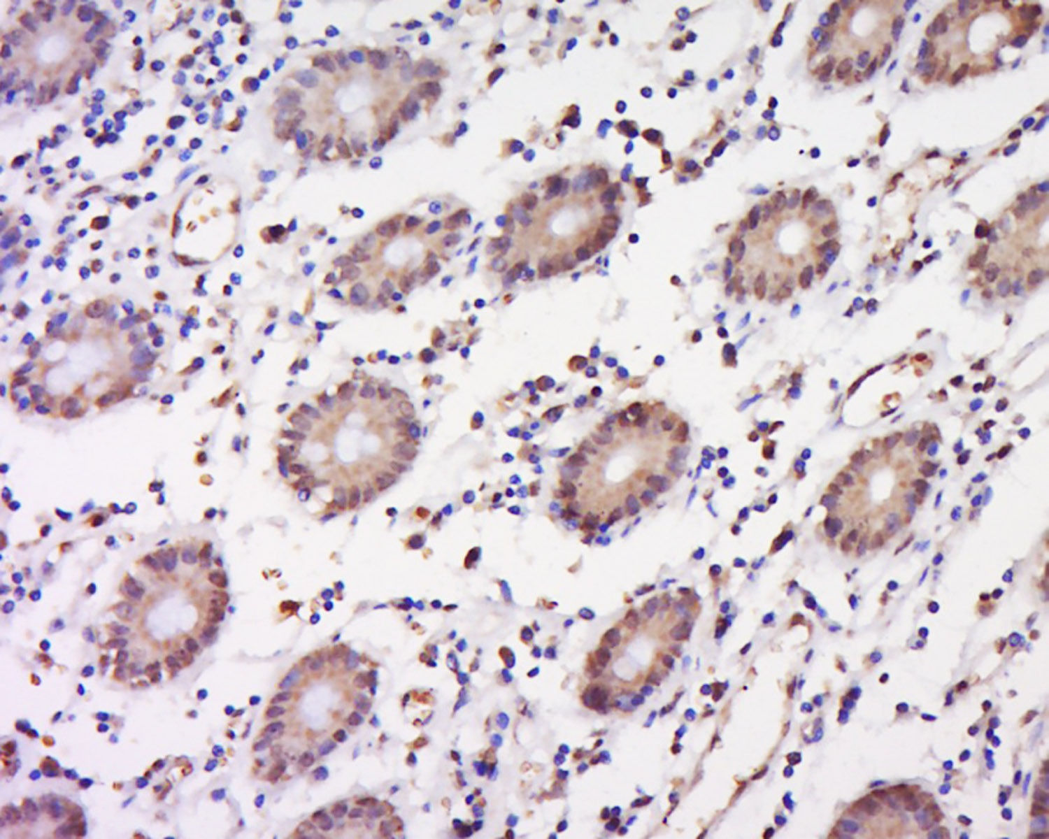 Rabbit anti-Phospho-IKBα(Tyr305) Polyclonal Antibody
