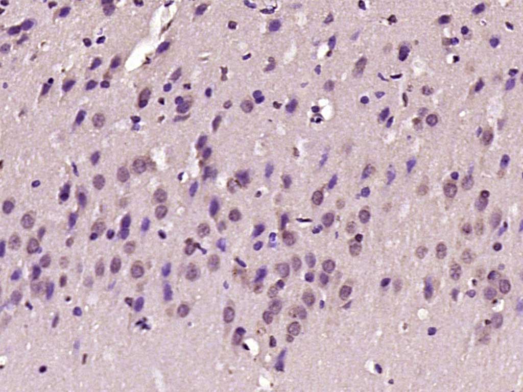 Rabbit anti-BTBD19 Polyclonal Antibody