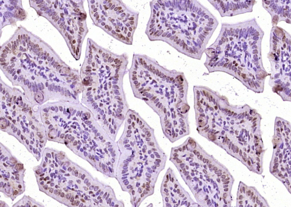 Rabbit anti-Phospho-β-Catenin(Ser33+Ser37) Polyclonal Antibody