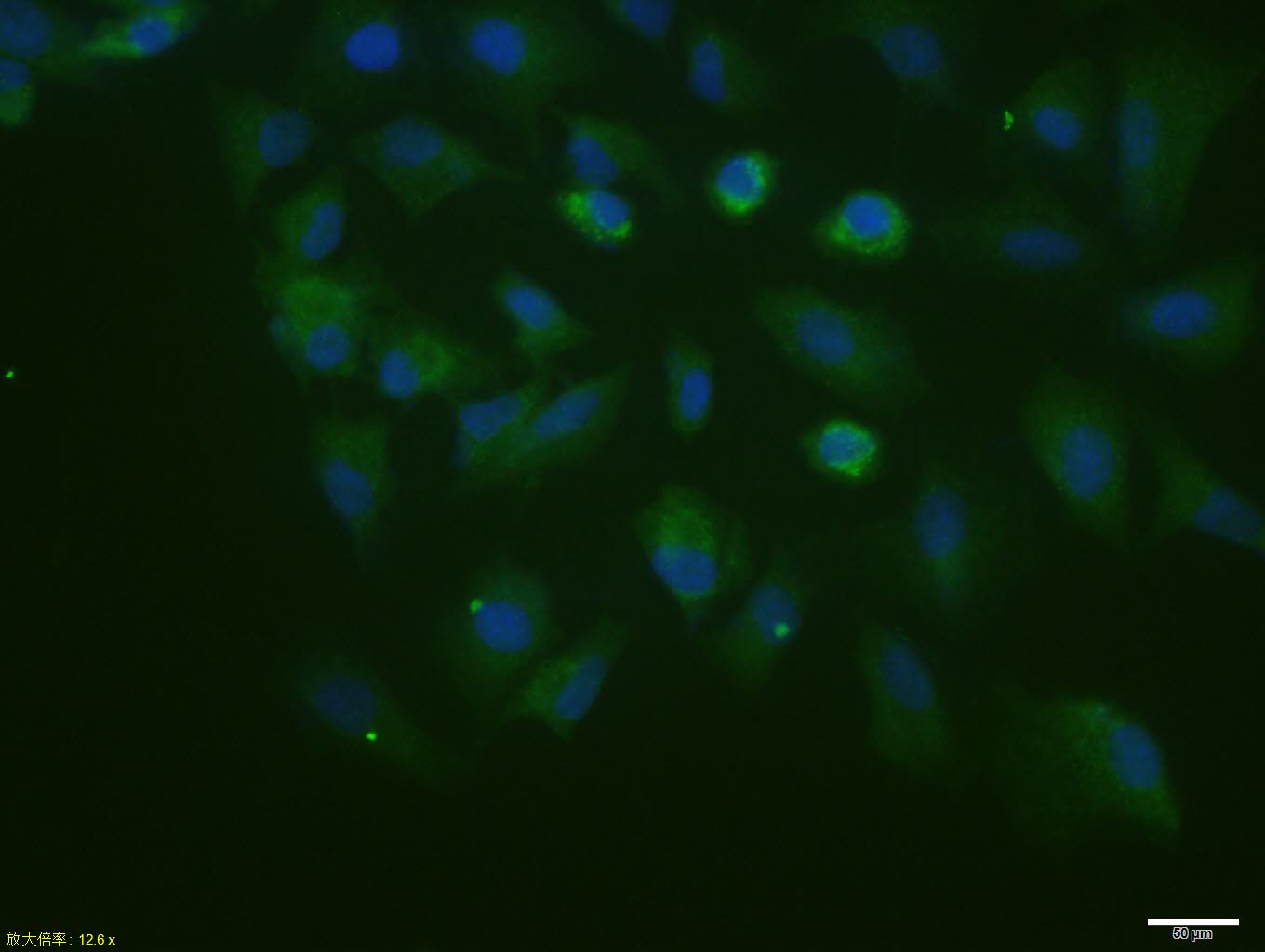 Rabbit anti-Phospho-P53(Ser46) Polyclonal Antibody