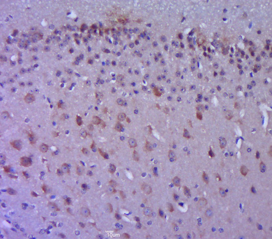 Rabbit anti-Phospho-FAK(Tyr861) Polyclonal Antibody