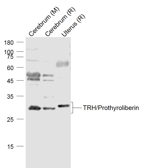 Rabbit anti-TRH Polyclonal Antibody