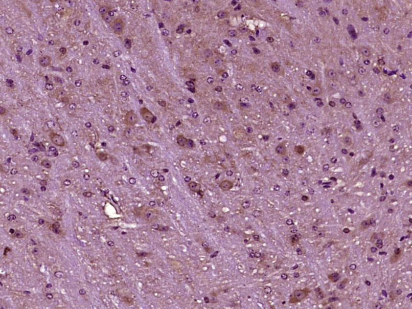 Rabbit Anti-MAP2K1IP1 Polyclonal Antibody